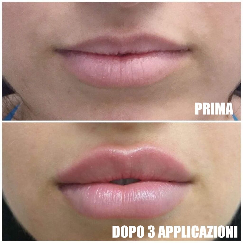 Natulips – Effetto immediato!!! – Effetto immediato!